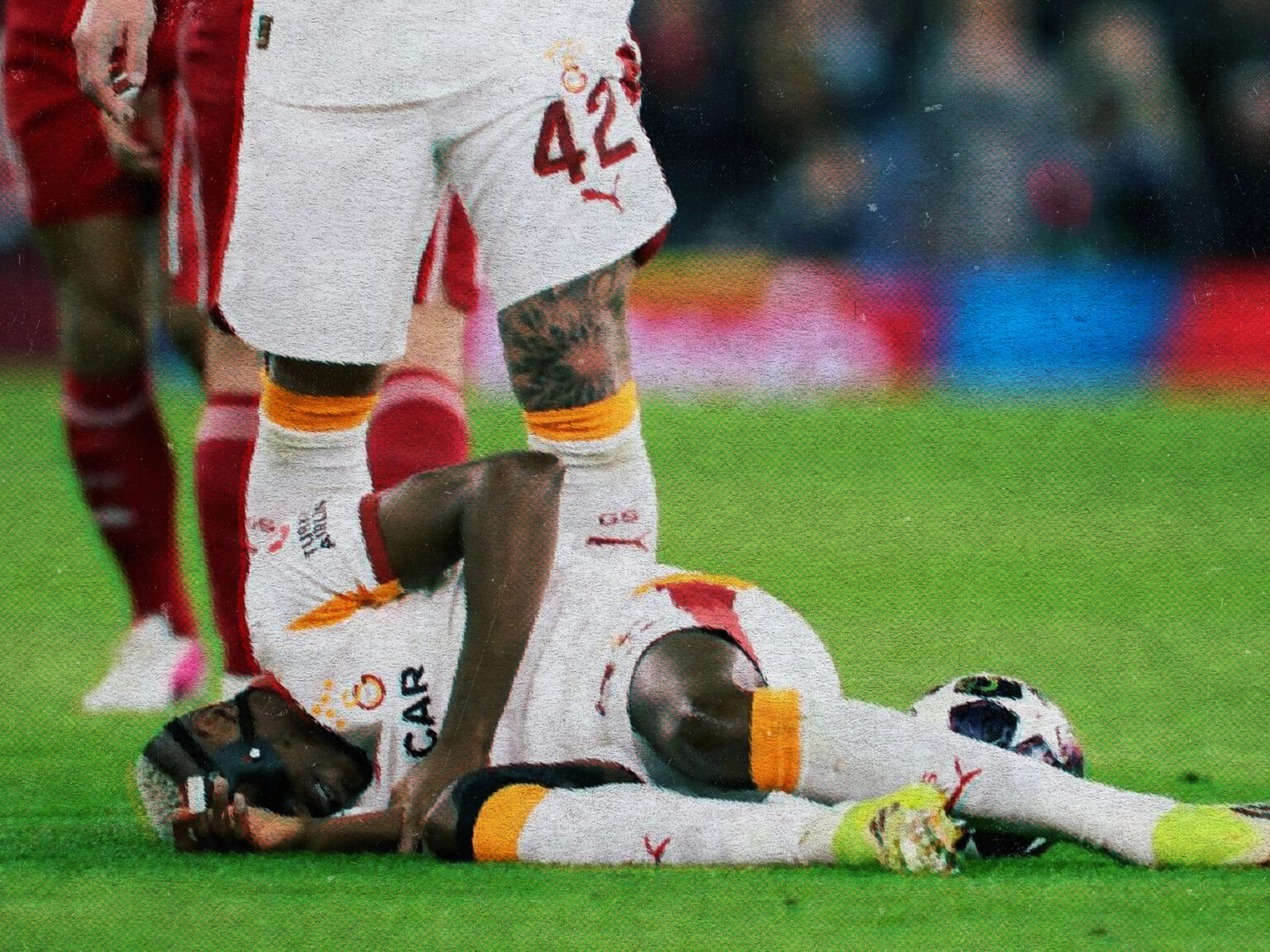 Victor Osimhen blessé au bras avec Galatasaray